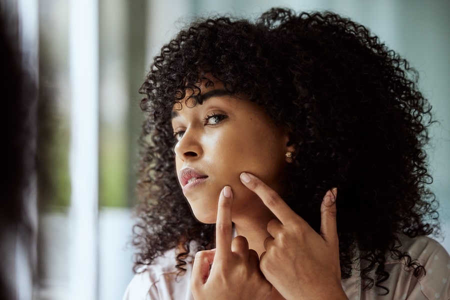 Remedies for Clearing Up Acne Fast